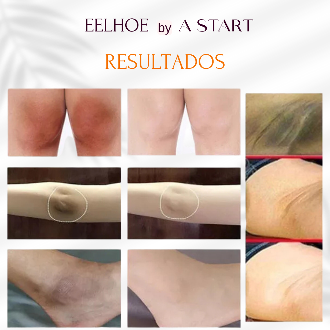 Clareador Facial e Corporal - EELHOE by A START