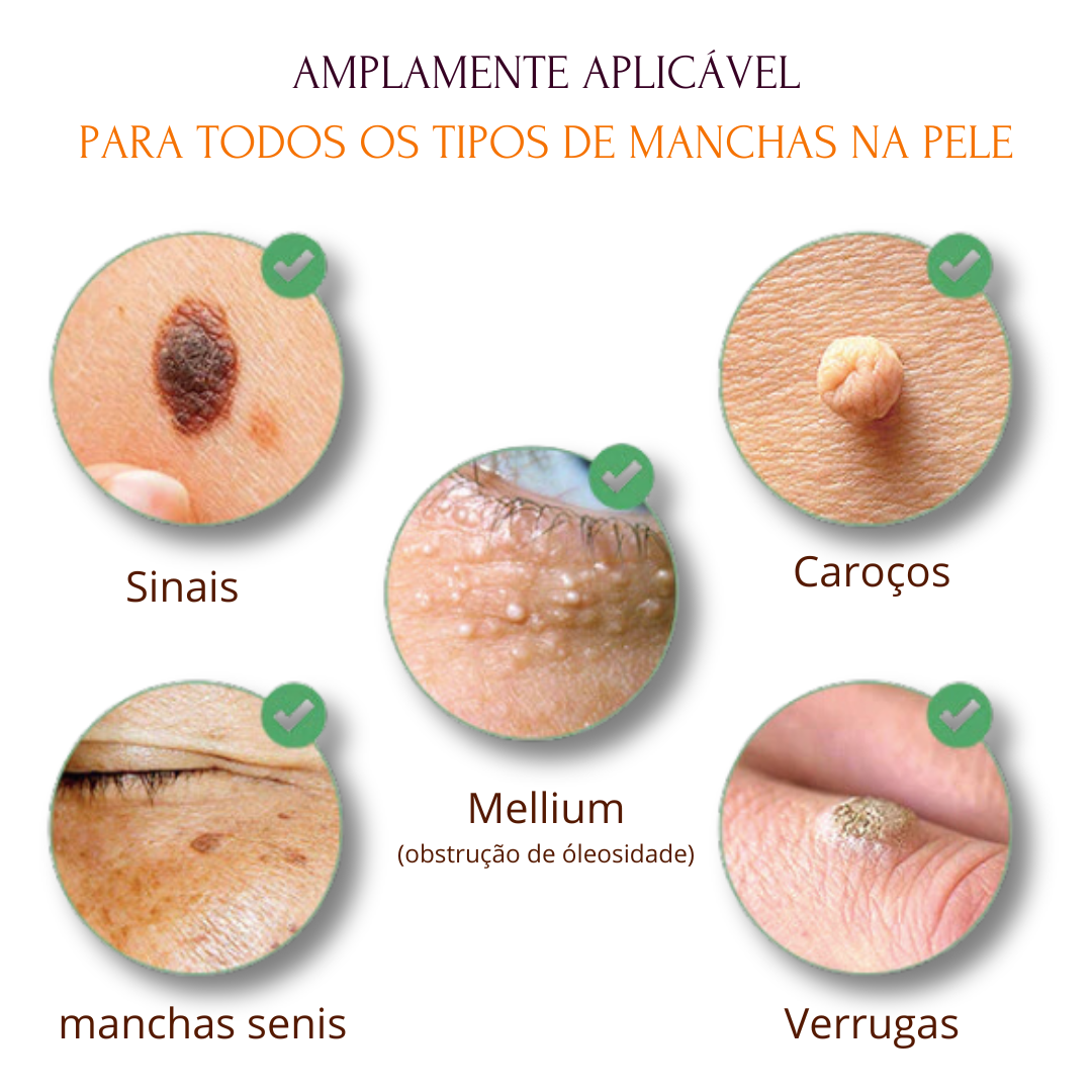 PeleLivre® - Adesivos Redondos Para Remover Manchas e Pintas